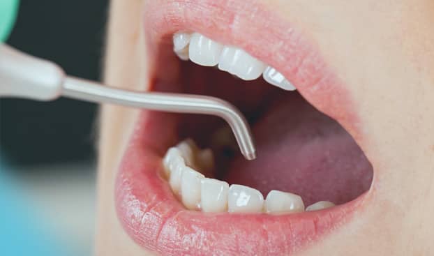 Treatment - Brunswick Dental Practice