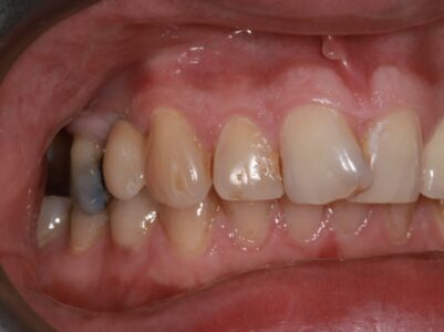 After - Brunswick Dental Practice